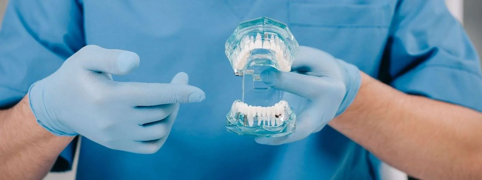 Dental model showing an implant-supported full arch of teeth, as used for All-on-4 treatment at Glendale Dental Wellness in Glendale, CA